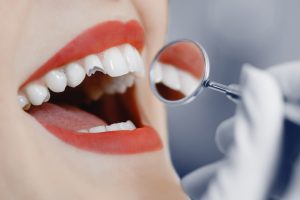 repair broken damaged tooth dental crown What are the Benefits of Tooth Fillings? repairs broken damaged tooth